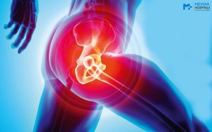 Minimally invasive hip replacement in Bangalore