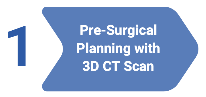 Pre surgical planning with 30 CT Scan