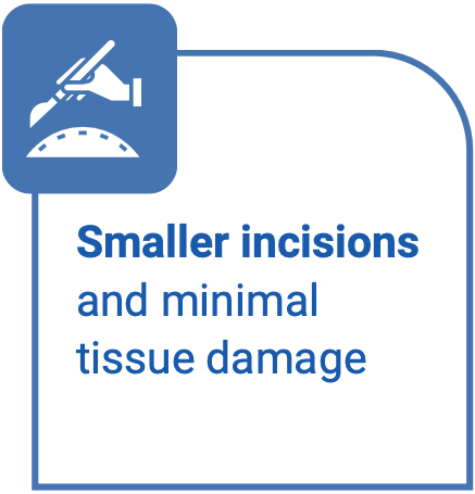 Smaller incisions and minimal tissue damage