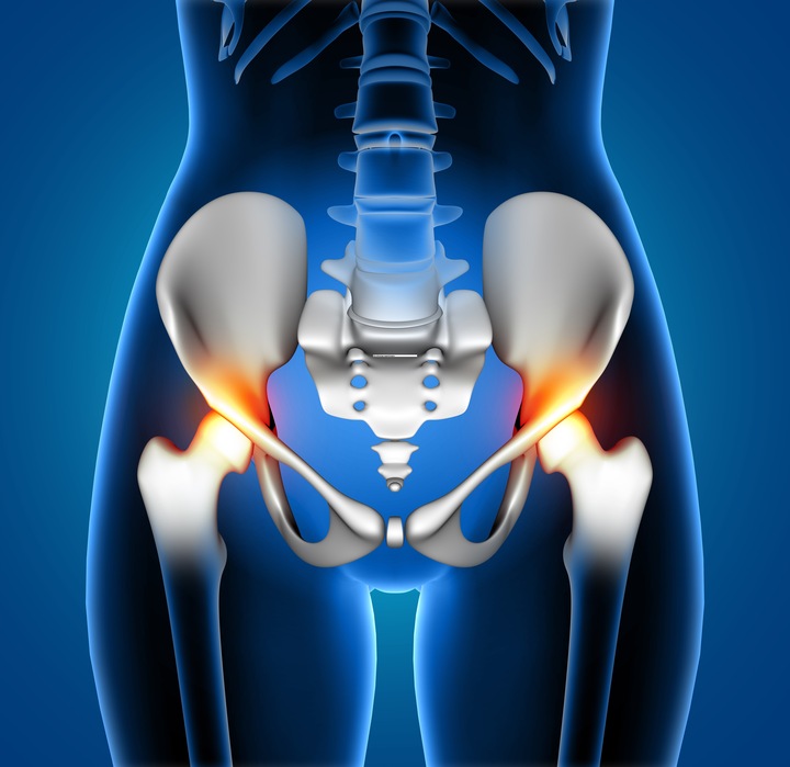 hip replacement surgery in bangalore