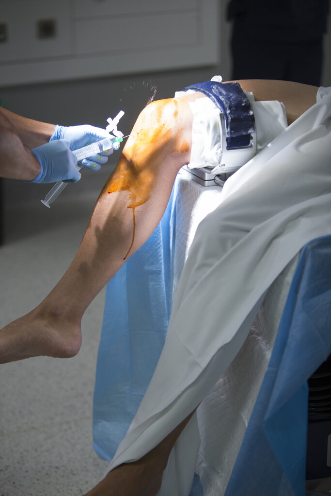 Best robotic knee replacement surgeon in Bangalore