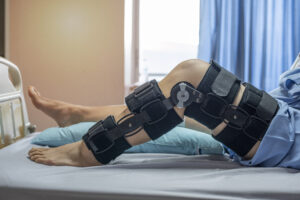 robotic knee replacement surgery cost in bangalore