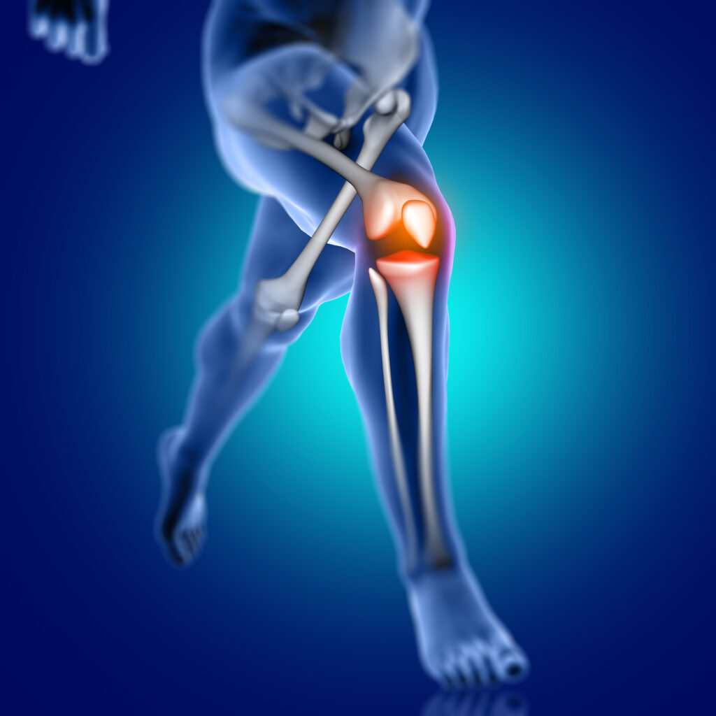 Best Knee Replacement Surgeon Bangalore