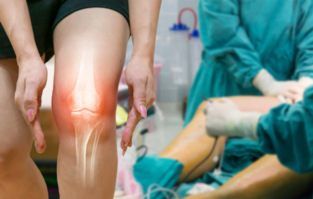 Top Knee Replacement Surgeons near Bangalore