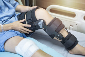 Best Knee Replacement Surgeon in Bangalore