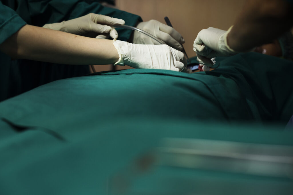 Minimally Invasive Hip Replacement in Uttarahalli