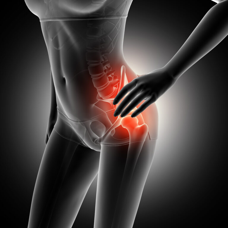 Pain due to anterior hip dislocation in hip joint
