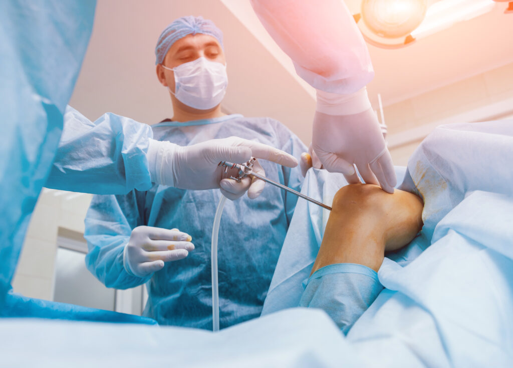 arthroscopic knee surgery procedure