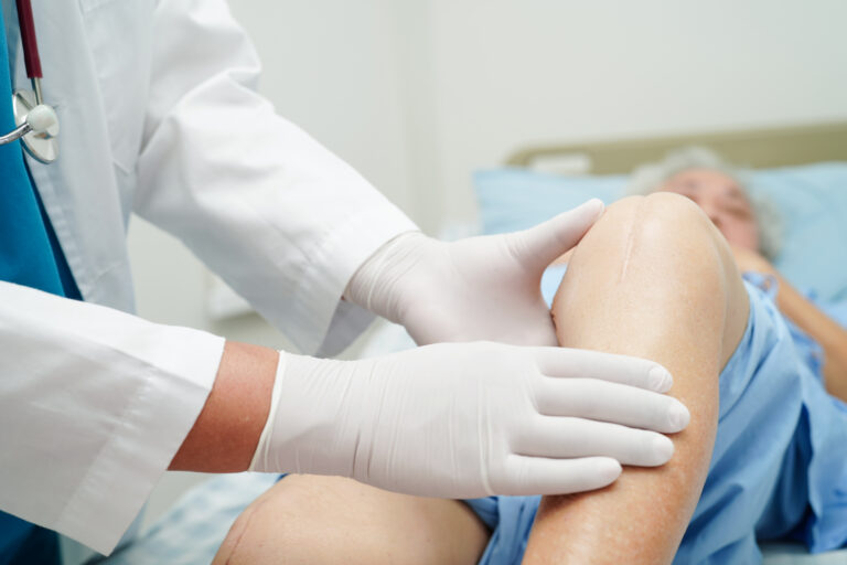 Doctor checking Asian elderly woman patient with scar knee repla