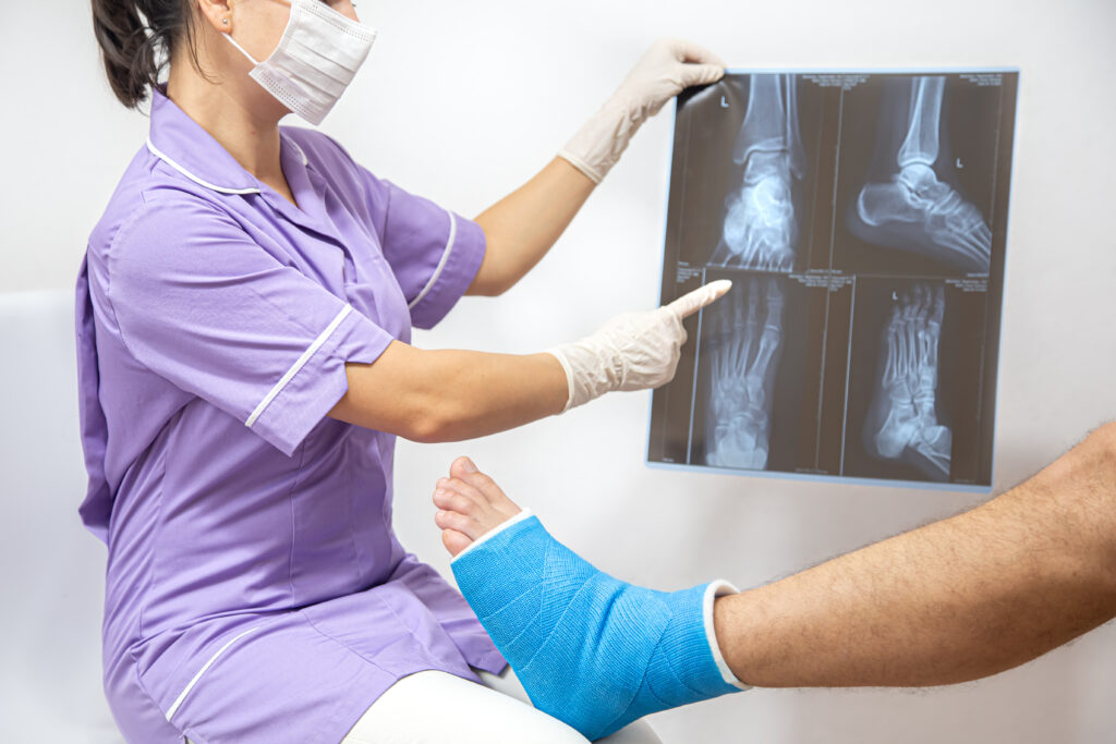 ACL Reconstruction Surgery Cost in Bangalore ACL Surgery Recovery Timeline Meniscus Surgery Recovery Guide Best Orthopedic Doctor in Electronic City Knee Arthroscopy Surgery in Bangalore What Happens If You Delay ACL Surgery?