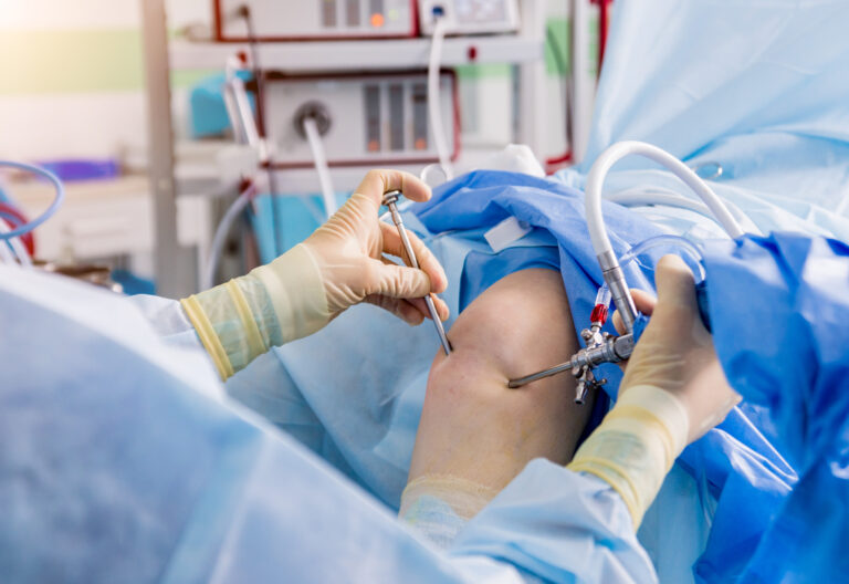 Surgeon performing arthroscopic ACL reconstruction surgery on a patient knee