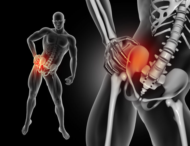 "3D medical illustration of hip joint pain and anatomy showing the hip area affected by joint damage"