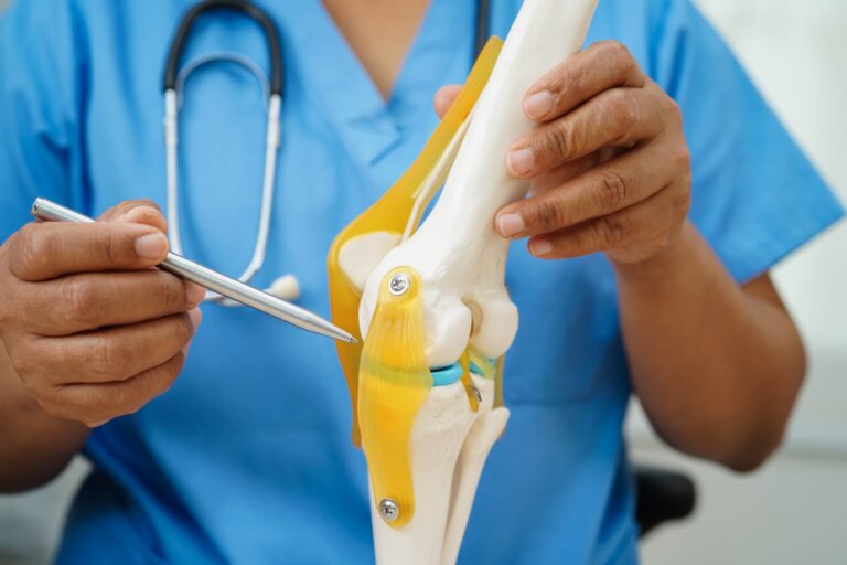 Recover faster with this ACL Reconstruction Rehabilitation guide. Learn the week-by-week recovery timeline, rehab stages, exercises, and return-to-sport milestones.